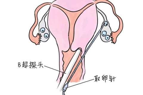 http://hy-ly.com/post/216.html|福州代生助孕